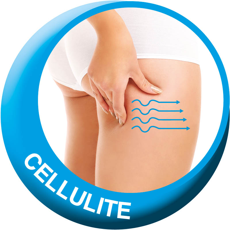 Cellulite-icon