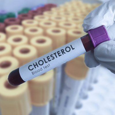 Cholesterol Test