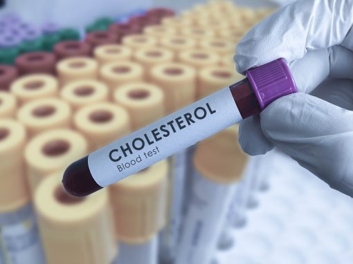 Cholesterol Test