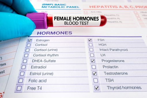 Female Hormone Test