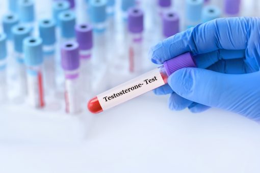 Testosterone Test