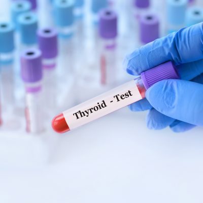 Thyroid Test